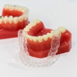 インビザラインのマウスピースと歯列模型