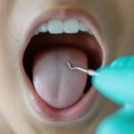 子供の口腔内を調べるイメージ