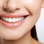 ホームホワイトニングで歯が白くなった女性