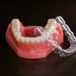 マウスピースのイメージ