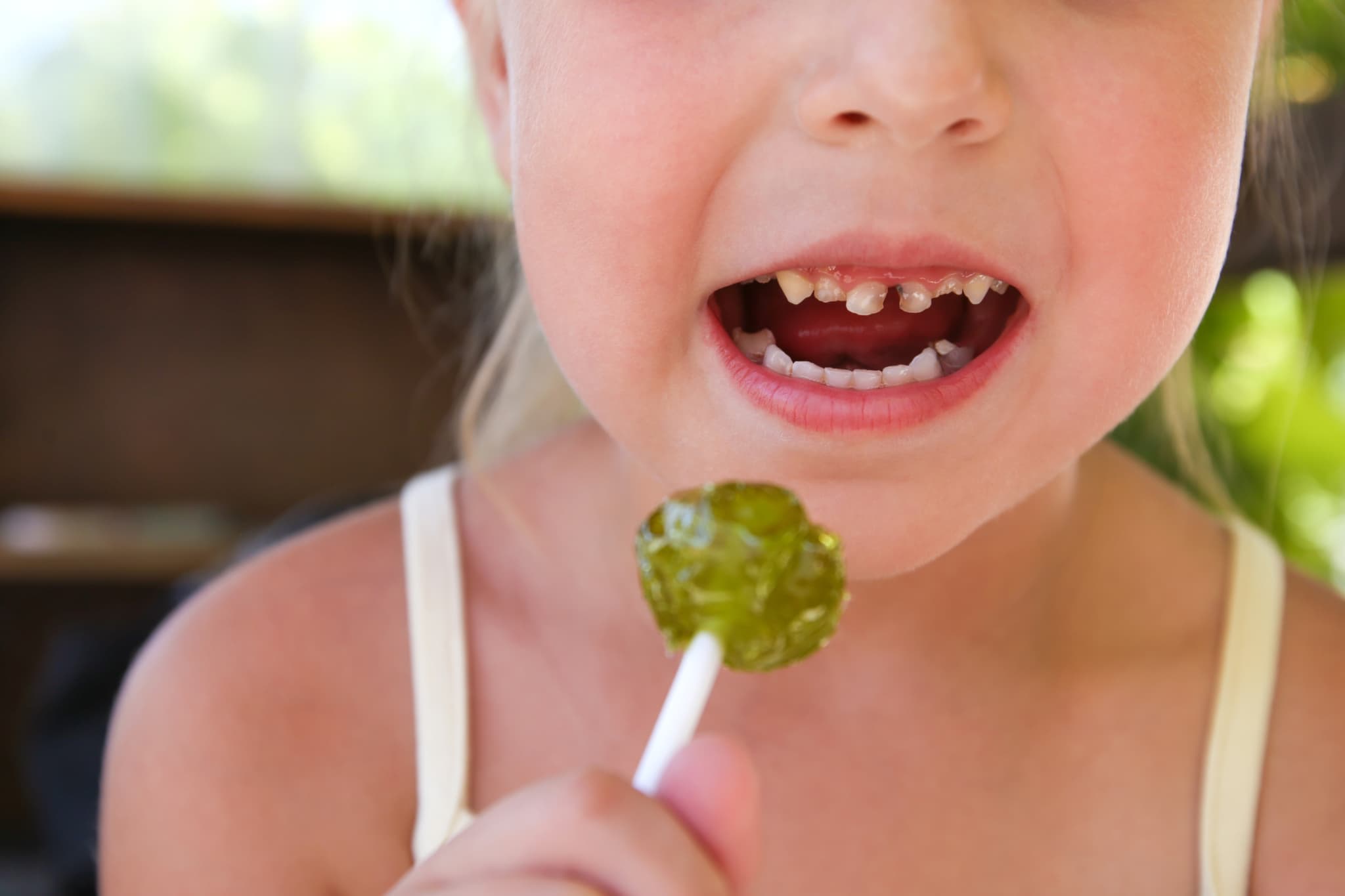 間食をだらだら食べ虫歯になる子ども