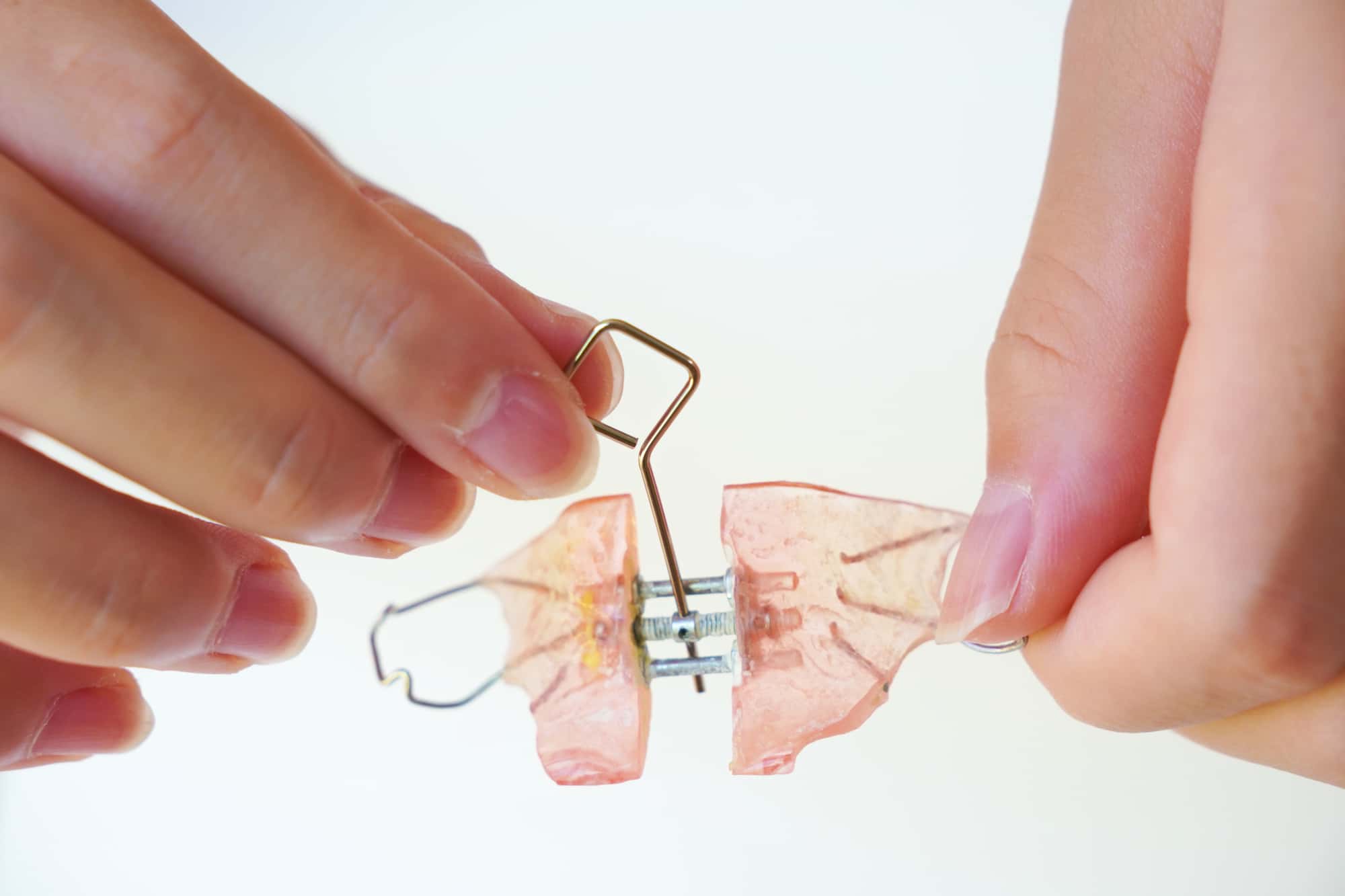 床矯正の器具のネジを回しているイメージ