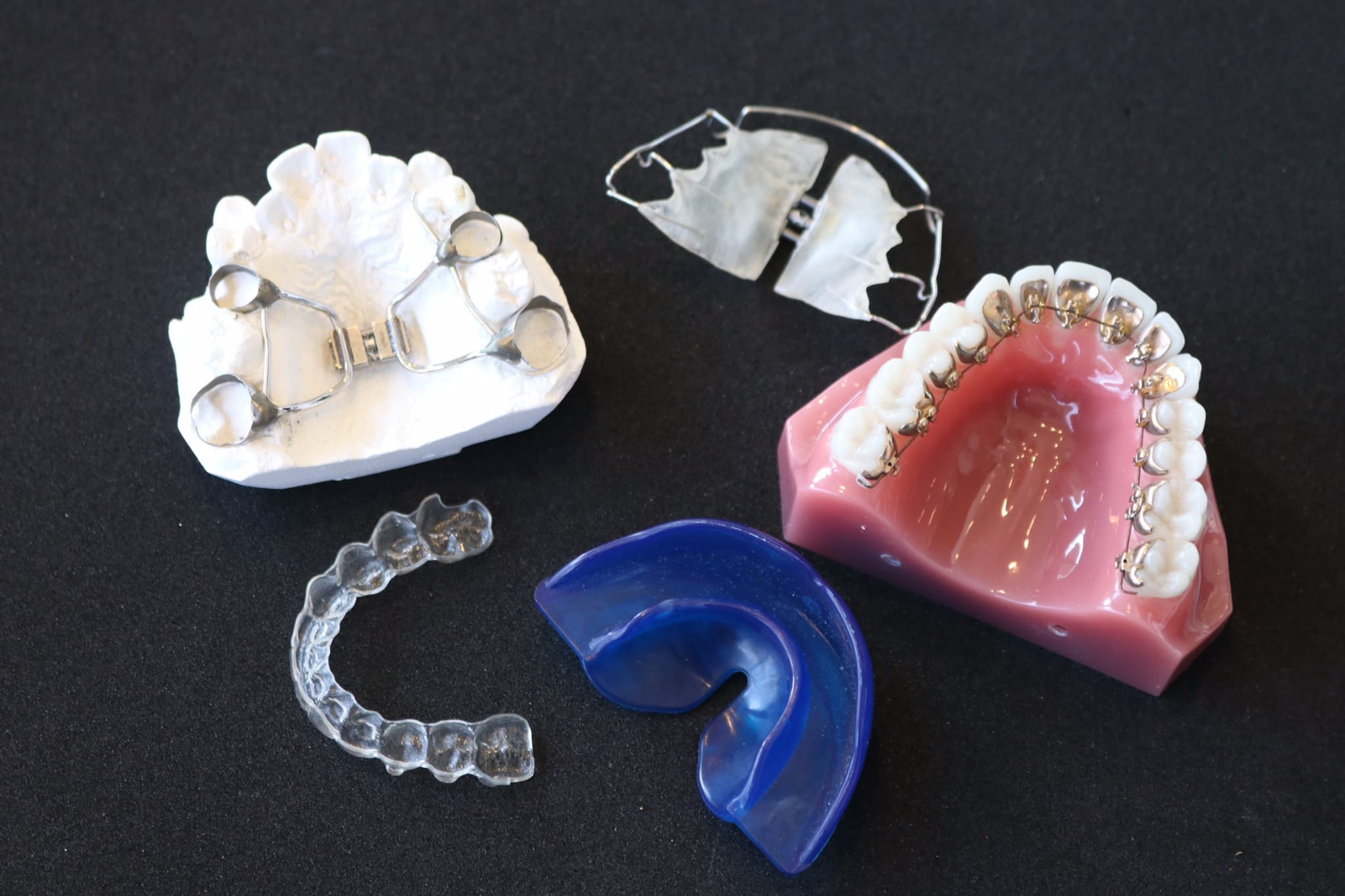 子どものすきっ歯を治療する矯正装置