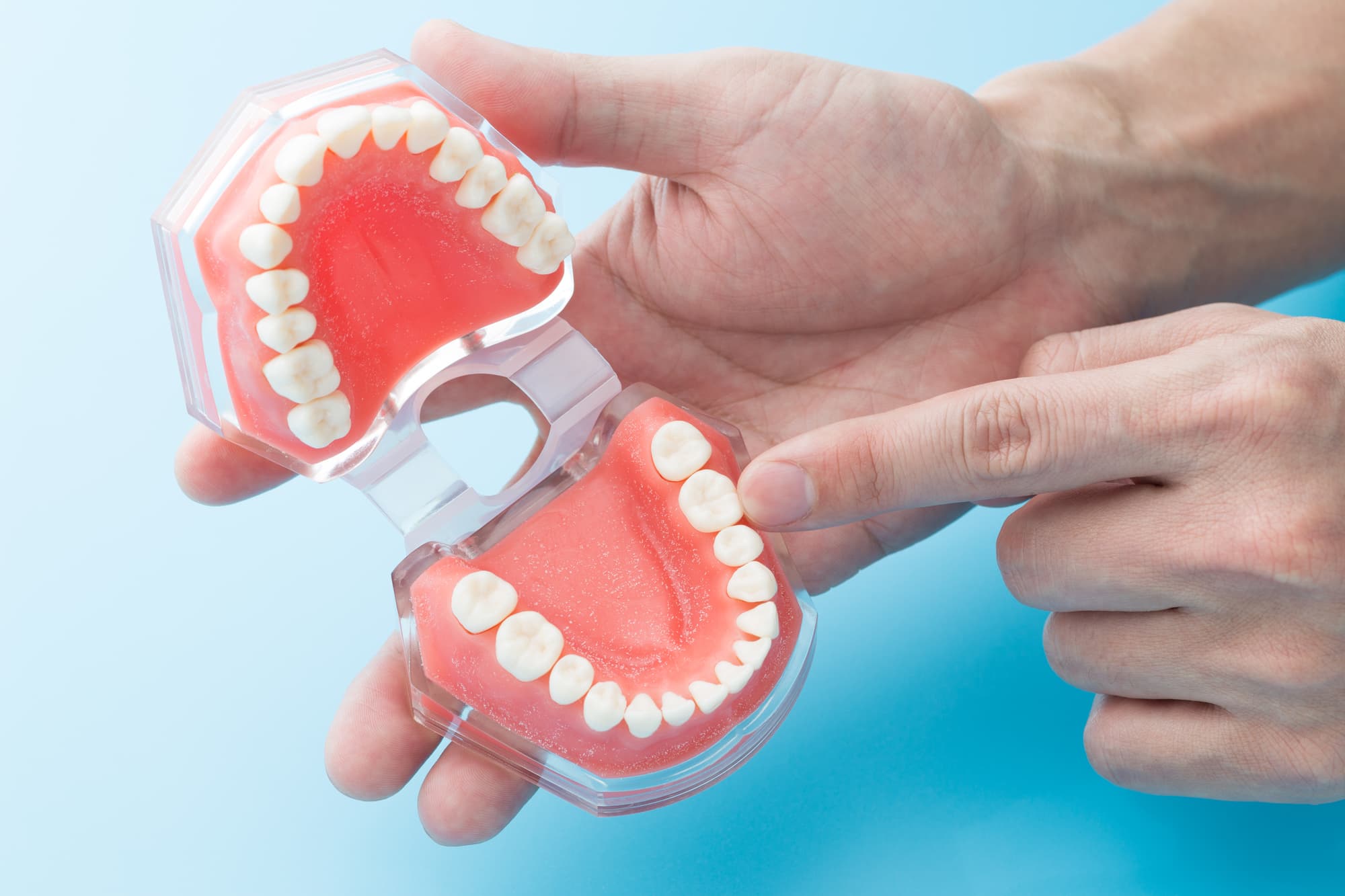 歯ぎしりについて歯の模型で説明するイメージ